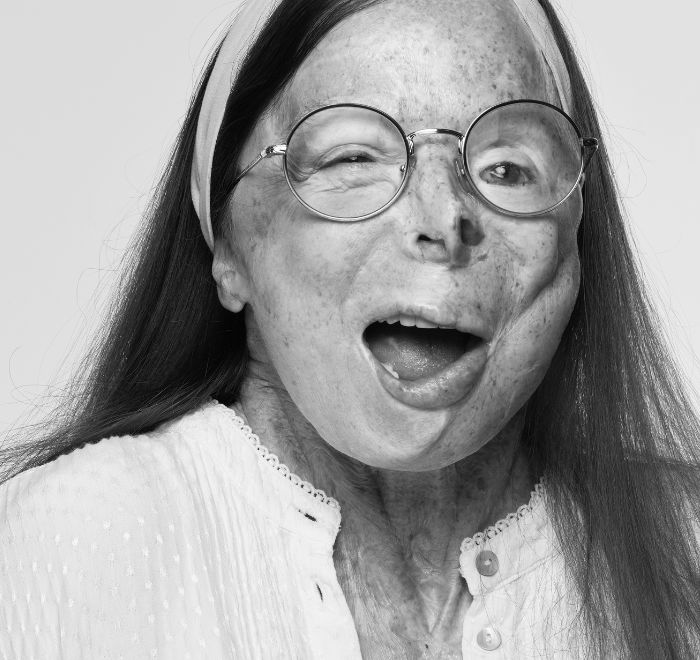 The ‘Tear Couture Look Book’ featuring acid attack survivor Patricia Lefranc – photographed by Rankin for MCCANN HEALTH LONDON and the Acid Survivors Trust International (ASTi) for you on GoSee.News